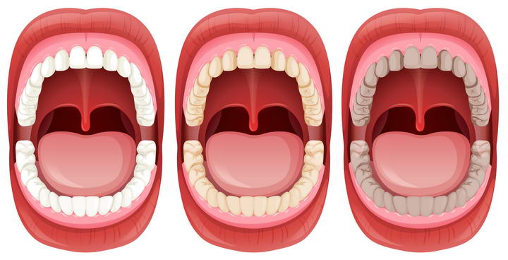 张开的嘴巴模型牙齿颜色示意图免扣图片素材