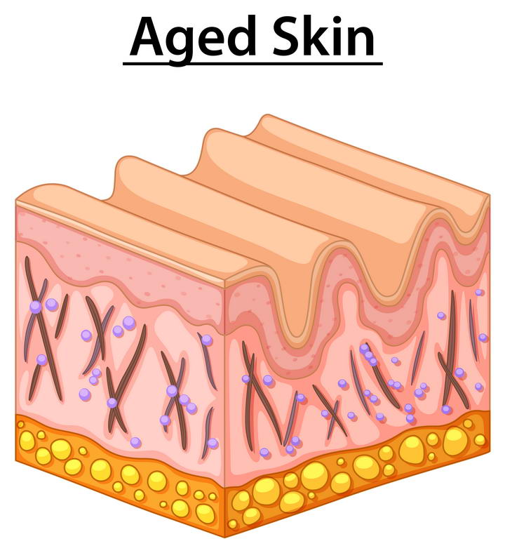老化产生皱纹的皮肤组织结构解剖图免扣图片素材