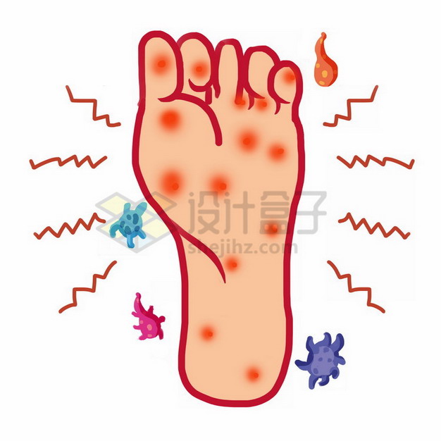 真菌感染的脚掌脚气卡通插画png免抠图片素材 健康医疗-第1张