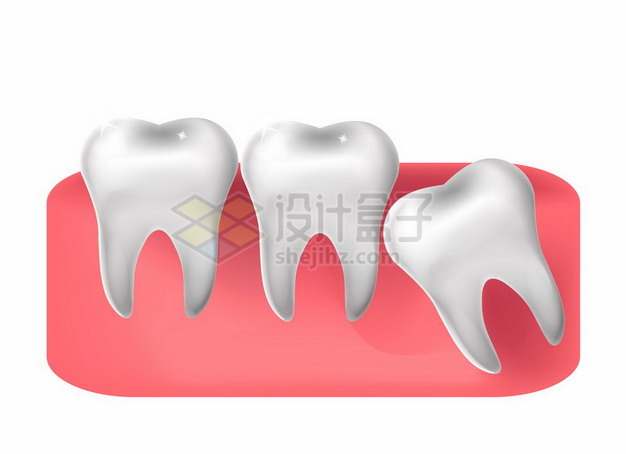 牙齿解剖图阻生智齿464044png图片素材