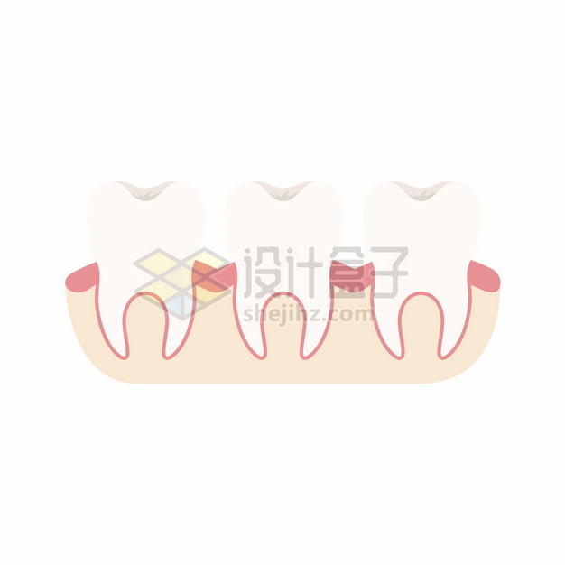 淡黄色的牙齿323975png图片素材 健康医疗-第1张