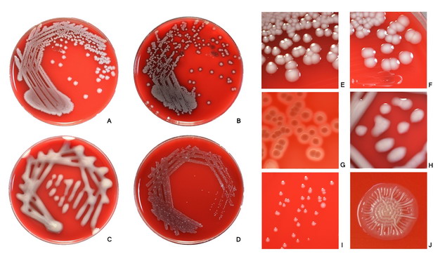 培养皿中的大肠杆菌菌落537587png图片素材 健康医疗-第1张