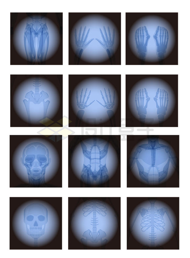 人体身体各个部位的X光照片9774348矢量图片免抠素材 健康医疗-第1张