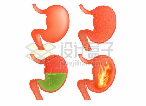 4款人体胃部内部结构胃胀胃酸胃痛胃上火等5628387矢量图片免费下载