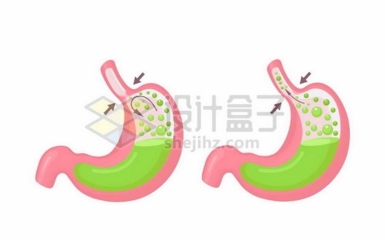 卡通人体胃部内部结构胃酸胃气胀胃难受6002581矢量图片免费下载
