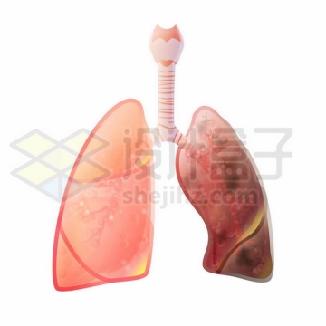 患病的肺部人体呼吸系统人体器官7682117矢量图片免抠素材