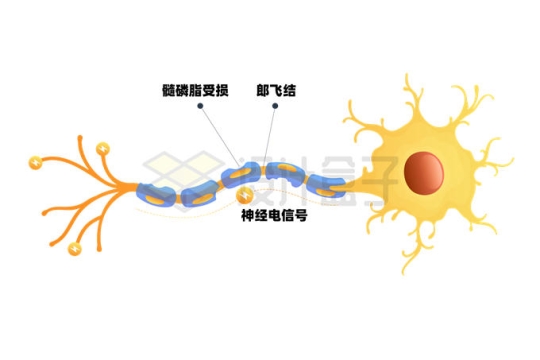 神经细胞髓磷脂受损郎飞结神经电信号结构图6757401矢量图片免抠素材
