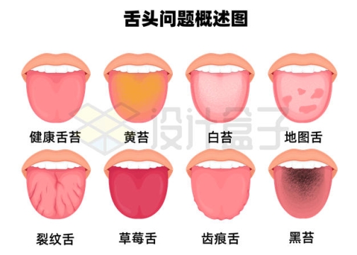 各种舌头问题病变示意图8363857矢量图片免抠素材下载