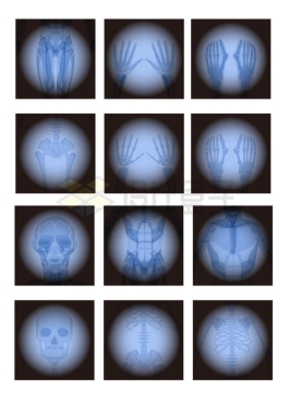 人体身体各个部位的X光照片9774348矢量图片免抠素材