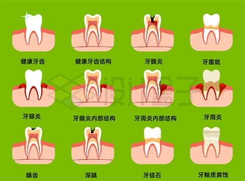 各种有问题的牙齿内部结构6703536矢量图片免抠素材下载