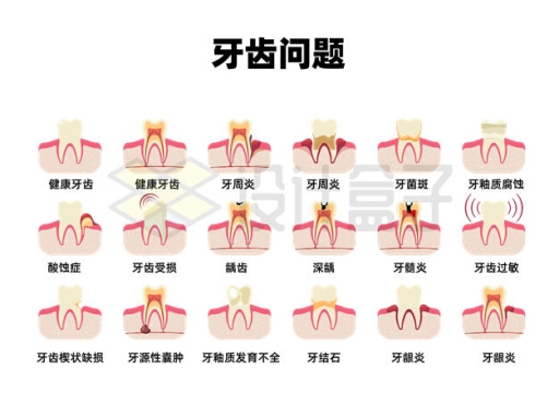 18种有问题的牙齿内部结构示意图8911946矢量图片免抠素材下载