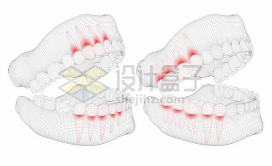 黑色线条网格组成的3D立体风格牙疼人体牙齿结构示意图9016381矢量图片免抠素材