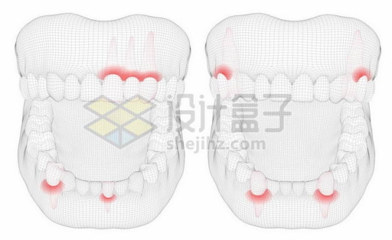 黑色线条网格组成的3D立体风格牙疼人体牙齿结构示意图4251207矢量图片免抠素材