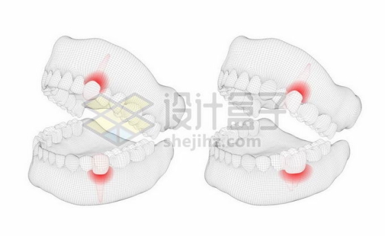 黑色线条网格组成的3D立体风格牙疼人体牙齿结构示意图4442533矢量图片免抠素材