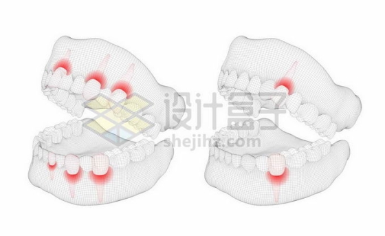 黑色线条网格组成的3D立体风格牙疼人体牙齿结构示意图1763912矢量图片免抠素材