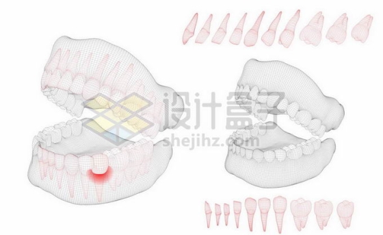 黑色线条网格组成的3D立体风格牙疼人体牙齿结构示意图9206305矢量图片免抠素材