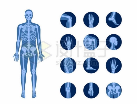 男性人体骨架和类风湿性关节炎身体痛点X光示意图8966355矢量图片免抠素材