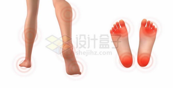 3D赤脚的人体脚底板小腿红色痛点示意图9687184矢量图片免抠素材