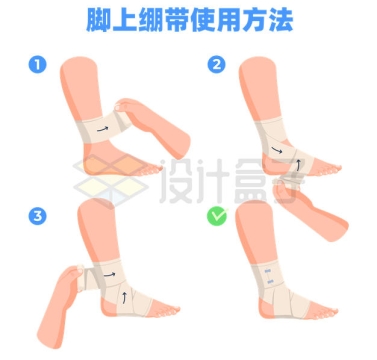 脚上受伤骨折绑绷带的使用绷带包扎步骤方法流程图3950529矢量图片免抠素材