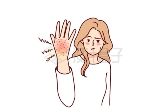 卡通女人过敏反应导致手上起红疹7710956EPS矢量图片免抠素材