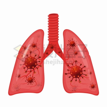 红色新型冠状病毒肺炎感染的肺部人体器官组织png图片免抠矢量素材