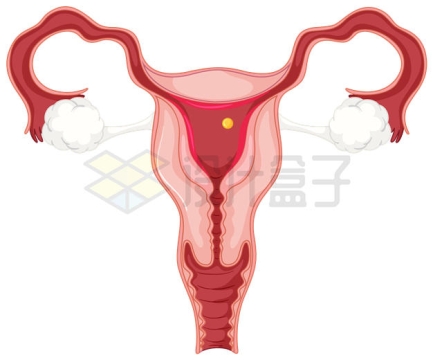 女性子宫内部结构解剖图5519399矢量图片免抠素材