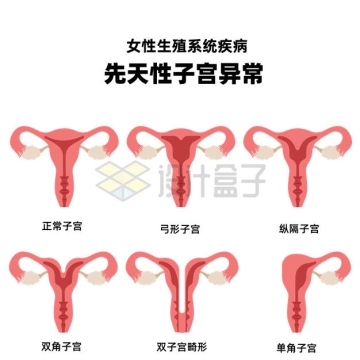 先天性子宫异常女性生殖系统疾病示意图8095977矢量图片免抠素材