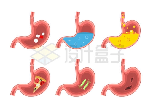 6款胃部结构胃病胃酸等2006605矢量图片免抠素材