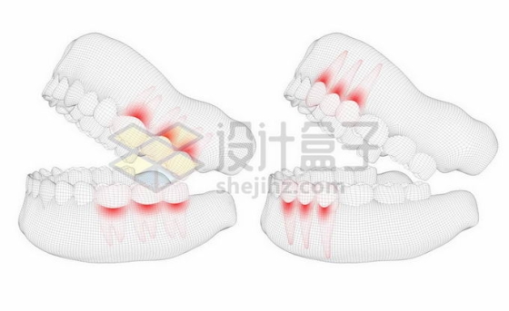 黑色线条网格组成的3D立体风格牙疼人体牙齿结构示意图2275997矢量图片免抠素材