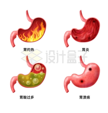 4款胃病胃灼热胃炎胃酸过多和胃溃疡7802643矢量图片免抠素材