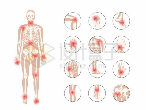 男性人体骨架和类风湿性关节炎身体痛点示意图7738758矢量图片免抠素材